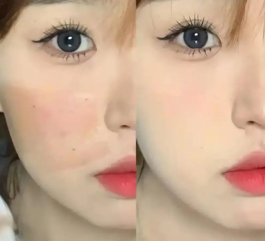 医用面膜