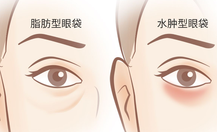 眼袋