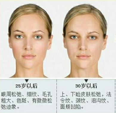 眼袋