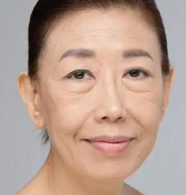 眼袋