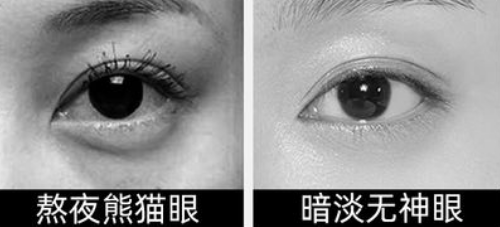 眼袋手术