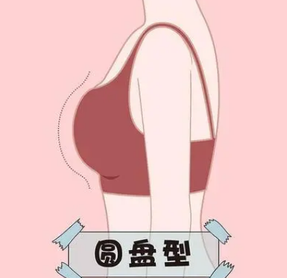 自体脂肪培养丰胸