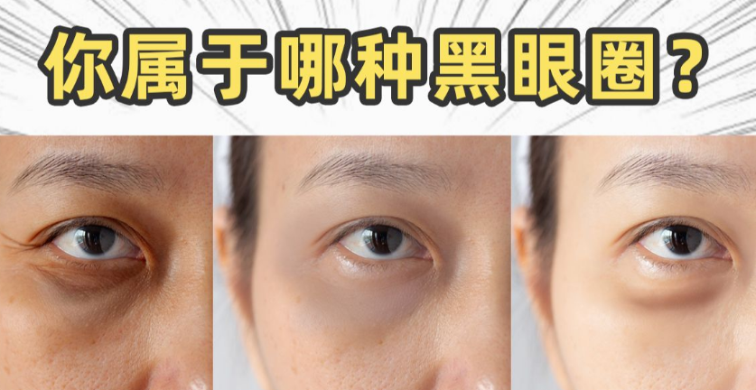 黑眼圈