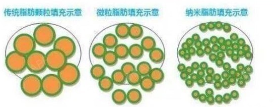 自体脂肪培养丰胸
