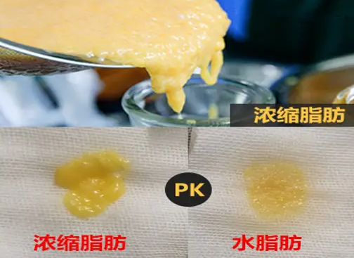 自体脂肪培养丰胸