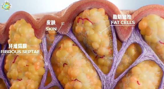 自体脂肪培养丰胸