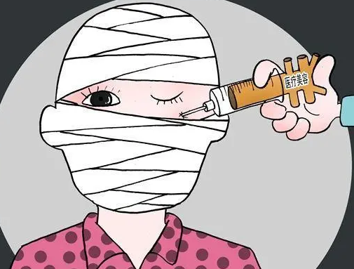 自体脂肪填充