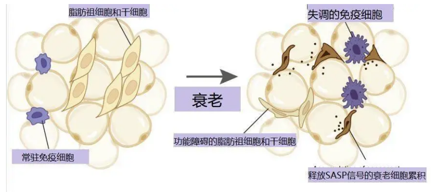 自体脂肪填充
