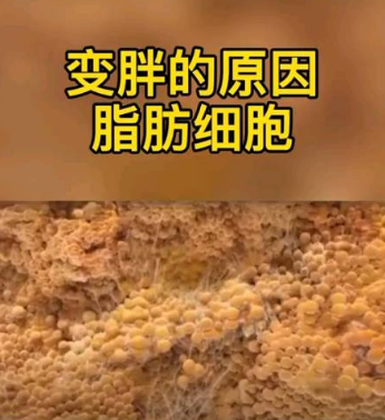 自体脂肪填充