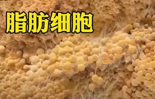 自体脂肪填充
