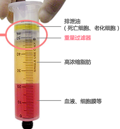 自体脂肪填充
