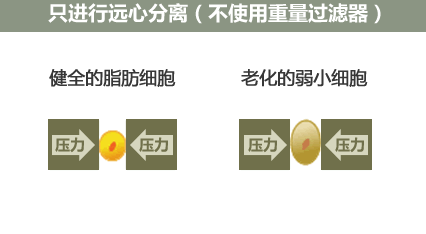 自体脂肪填充