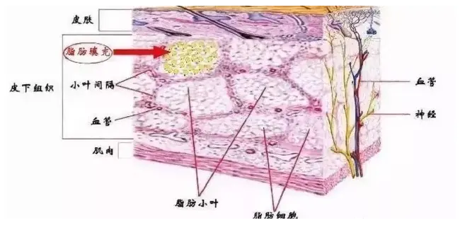 自体脂肪培养丰胸