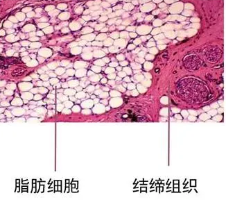 自体脂肪培养丰胸