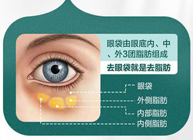 眼袋手术