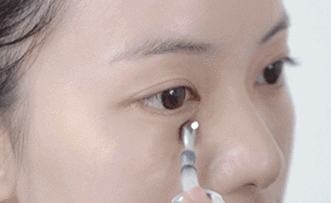不开刀按摩去眼袋