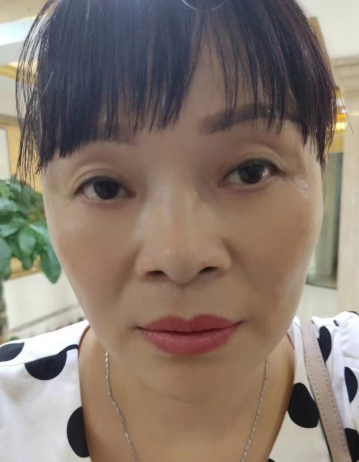 眼袋手术