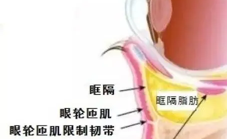 眼袋手术