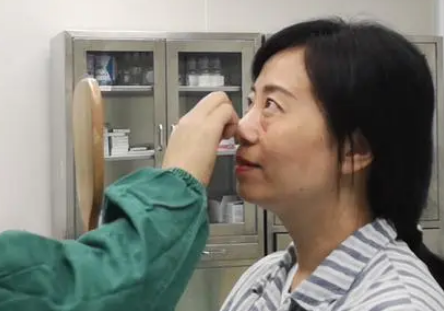 去眼袋手术