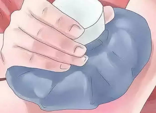 眼袋手术