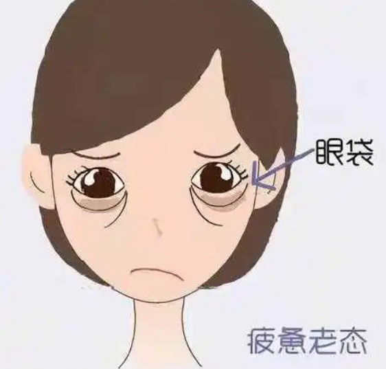 眼袋手术