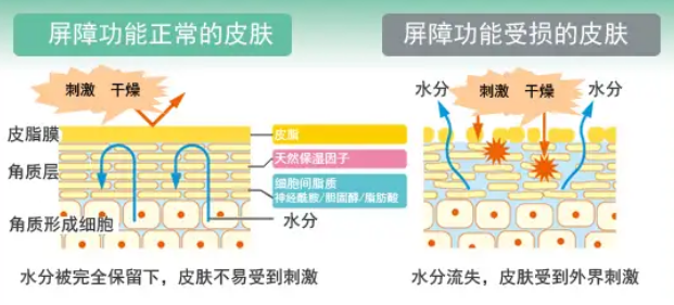 眼袋手术