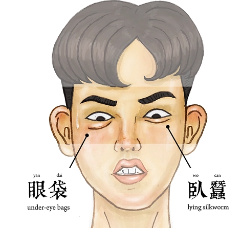 眼袋手术