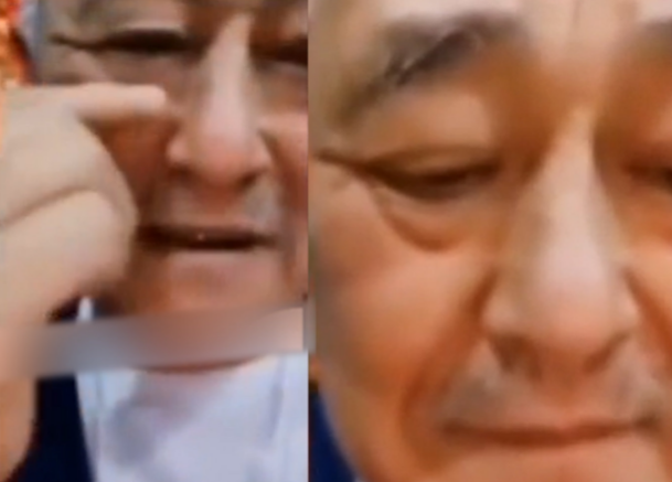 眼袋