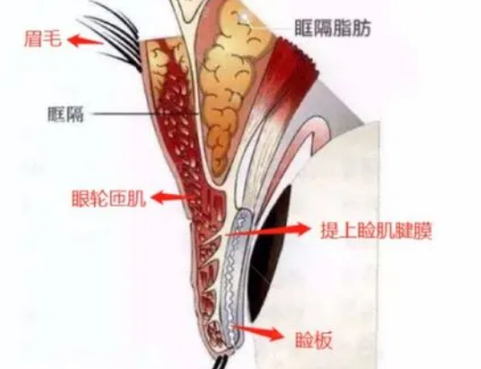 双眼皮手术