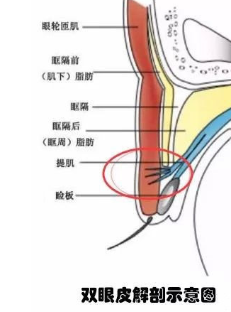 双眼皮手术
