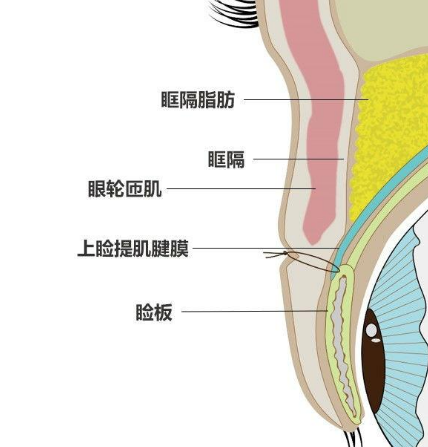 双眼皮手术