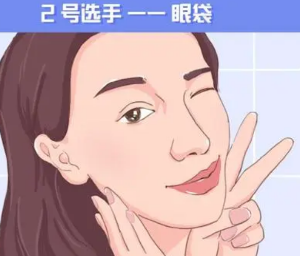 去眼袋手术