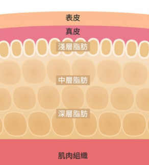 自体脂肪胶