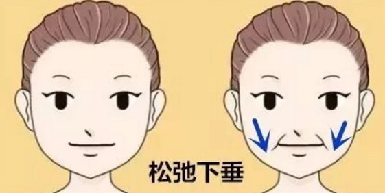 自体脂肪胶