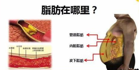 自体脂肪胶