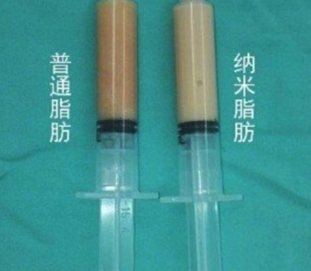 自体脂肪胶
