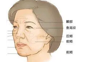 泪沟填充