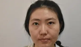去眼袋手术