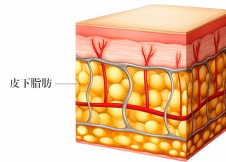 自体脂肪胶