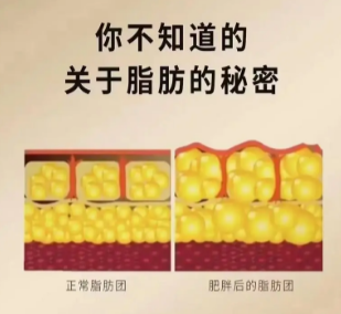 自体脂肪胶