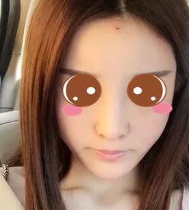 丰胸