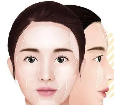 自体脂肪胶
