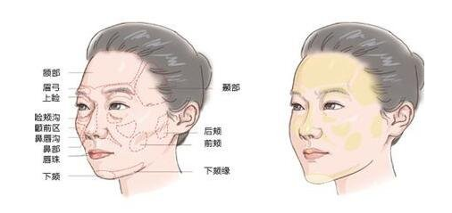 自体脂肪胶
