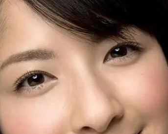 去眼袋手术