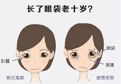 去眼袋手术