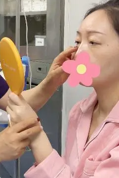 去眼袋手术