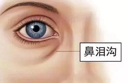泪沟