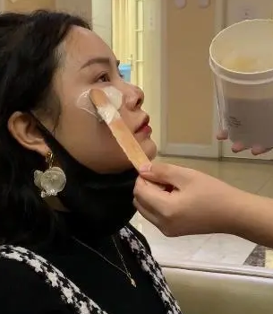 自体脂肪胶