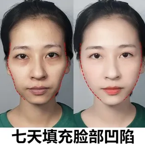 自体脂肪胶