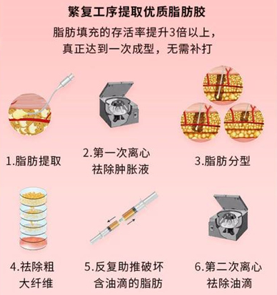 自体脂肪胶